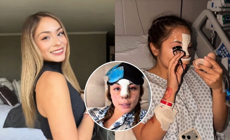 Skarleth Labra se aburrió del ‘hate’: respondió sin filtro a odiosos comentarios sobre su cirugía
