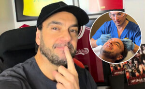 Rodrigo Sepúlveda mostró novedoso tratamiento capilar al que se sometió: “Un mundial con pelo”